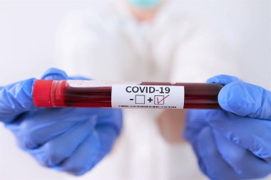 Koronavirüs kan örneği tüpü koruyucu maske ve eldiven takan bir doktorun elinde.