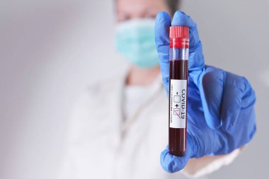 COVID-19 salgını. Doktor elinde Coronavirüs enfeksiyonu olan kan örneği tutuyor.. 