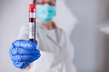 Doktor elinde Coronavirus enfeksiyonu taşıyan, maske ve eldiven takan negatif kan örneği tutuyor. Salgın COVID-19