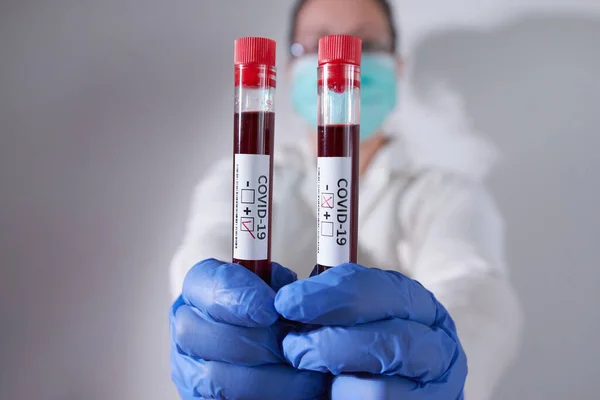 Médico Segurando Positivo Negativo Amostra Sangue Infectado Com Coronavirus Usando — Fotografia de Stock