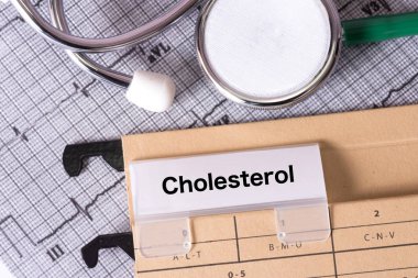 Elektrokardiyogram EKG, stetoskop ve word kolesterol ile asılı klasör