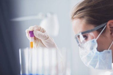 Laboratuvarda sıvı yeşil çözeltiye bakan bir tıbbi veya bilimsel araştırmacı ya da doktor