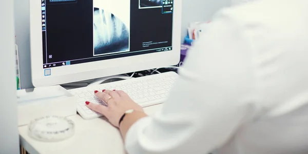 Lekarka patrząca na prześwietlenia i używająca laptopa w szpitalu. — Zdjęcie stockowe