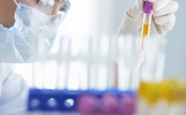 Laboratuvarda sıvı yeşil çözeltiye bakan bir tıbbi veya bilimsel araştırmacı ya da doktor
