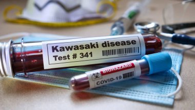 Kawasaki disease test. covid-19 pediatric multisystem inflammatory syndrome. clipart
