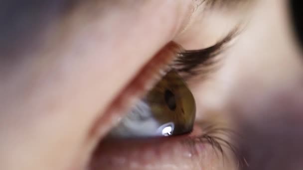 Makro Göz Kornea Göz Altı Hastalığı Keratoconus Kornea Nakli Çapraz — Stok video