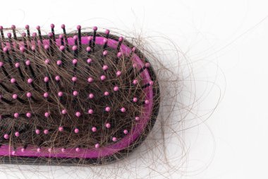 Beyaz arka planda tarakta saç kaybı. Kellik.