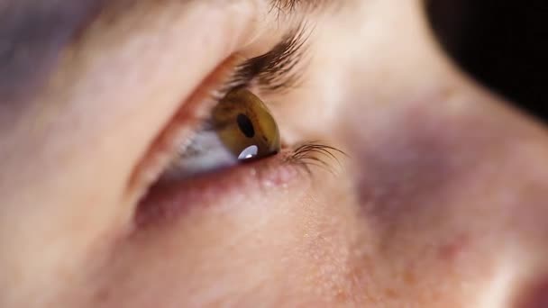 Makro Göz Kornea Göz Altı Hastalığı Keratoconus Kornea Nakli Çapraz — Stok video