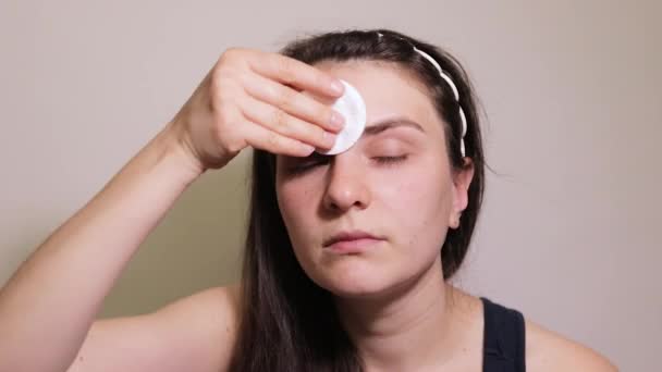 一个30岁的女人用棉垫和补品擦拭她的脸 面部皮肤护理 — 图库视频影像