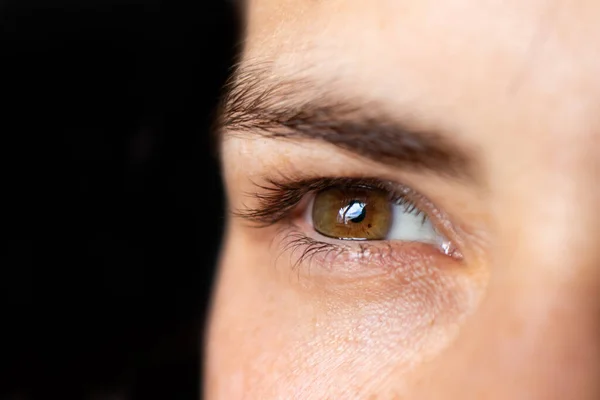 Foto macro-ocular. Ceratocone - doença ocular, afinamento da córnea na forma de um cone. O plástico da córnea — Fotografia de Stock