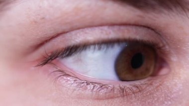 Makro göz fotoğrafı. Keratoconus - göz hastalığı, koni şeklinde korneanın seyrelmesi. Kornea plastiği.