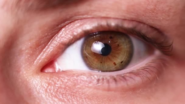 Makro göz fotoğrafı. Keratoconus - göz hastalığı, koni şeklinde korneanın seyrelmesi. Kornea plastiği. — Stok video