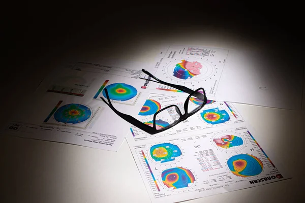 25.07.2020, Zarorizhzhya. Topografi av hornhinnan i ögat, layout. Keratokonus och glasögon. Keratotopografi - oftalmologisk undersökning. — Stockfoto