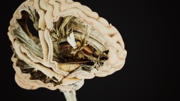 Medizinische Anotomie des echten menschlichen Gehirns — Stockvideo