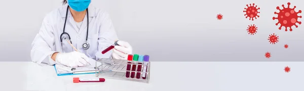 2019 nCoV kan tüplerinden alınan hasta kan testinin el yazısı sonucu laboratuarda beyaz fotokopi uzayı ile analiz edildi. Coronavirus kan testi kavramı. 