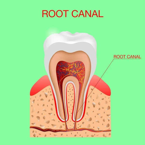 Canale radicolare. Infografica dentale. La struttura interna e il diagramma dei denti e il vettore grafico illustrazione — Vettoriale Stock