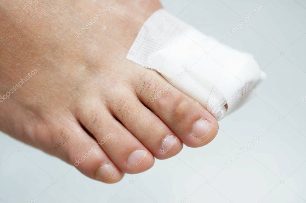 Big toe nail wounded by gauze dressing and dry skin on white backgrouond.