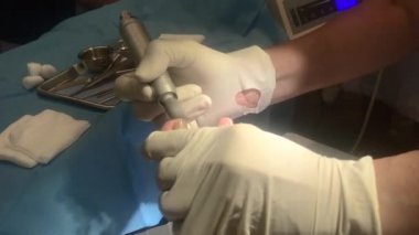 Pedicurist were gloves use polishing machine for polish toenail and scrub out keratolytic of skin to smooth under the lamp. Healthcare and medical concept footage.