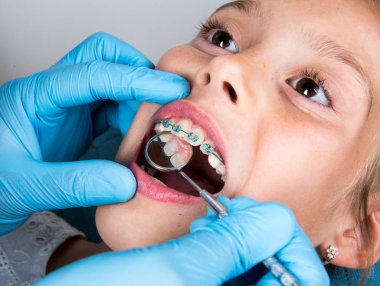 Diş hekimi, Ortodontist ayna ile küçük bir kız hastanın dişlerini muayene