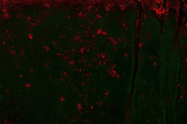 Metal plaka dokusu ve arka plan. Metal yüzey paslanmış lekeler. Paslı metal arka plan. Metal arkaplan.