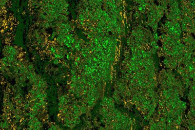 soyut yeşil doku arkaplanı, boşluk duvar kağıdını kopyala