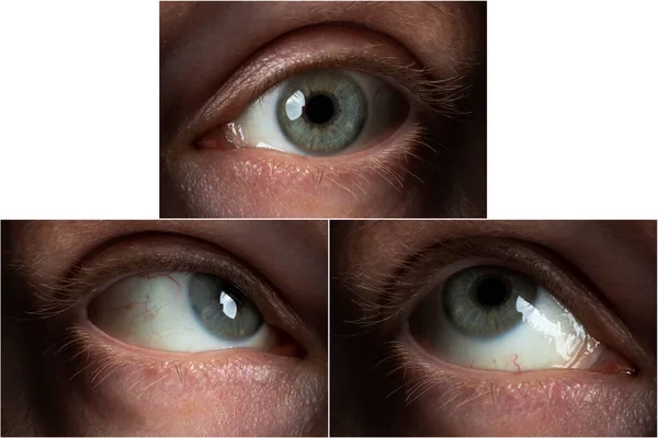 Das Auge Eines Erwachsenen Männchens Drei Verschiedenen Positionen Mit Blick lizenzfreie Stockfotos