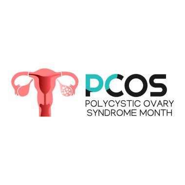 Polisistik Yumurtalık Sendromu ayının vektör grafiği Polycystic Yumurtalık Sendromu kutlamaları için iyidir. düz dizayn. Broşür tasarımı. Düz çizim. PCOS,