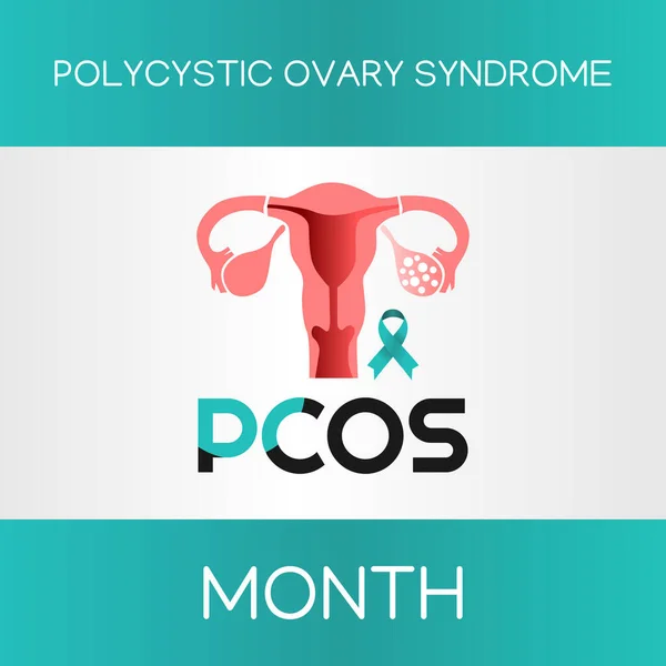 Polisistik Yumurtalık Sendromu ayının vektör grafiği Polycystic Yumurtalık Sendromu kutlamaları için iyidir. düz dizayn. Broşür tasarımı. Düz çizim. PCOS,