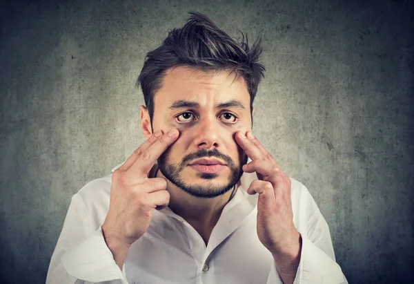 Joven Hombre Aspecto Divertido Cansado Haciendo Mueca Derribando Piel Las — Foto de Stock