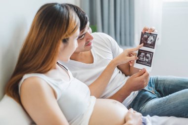 Genç Asyalı çift, ellerinde bebeklerinin ultrason görüntülerini beyaz yatakta tutuyorlar.