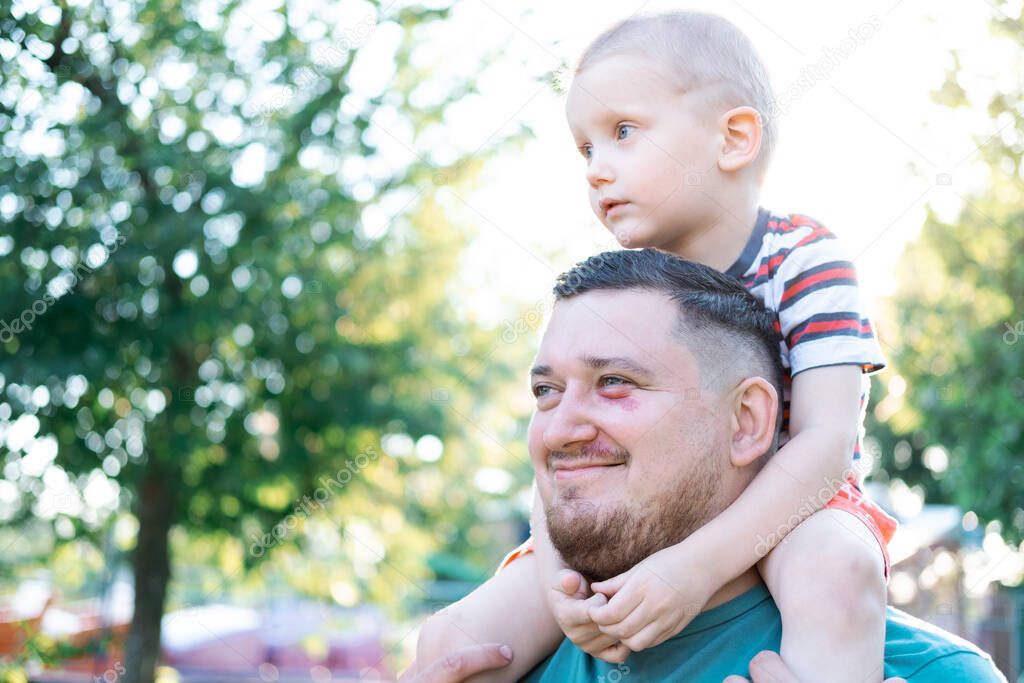 Funny blond boy with his father are in the park. Boy is sitting on the fathers shoulders. Happy adult father holding son on his shoulders. Smiling baby. Cute family Love Care