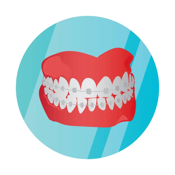 Dental Implant Icon Flat Color Style Vector Illustration — Stock Vector