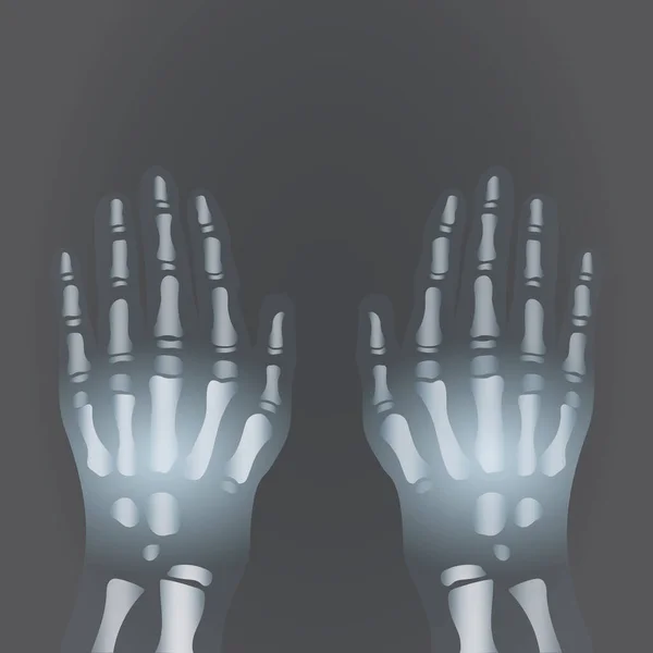 用X光透视人手的矢量图解 — 图库矢量图片