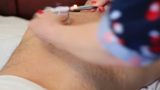 Frau Behandelt Mann Mit Akupunktur Schröpfen — Stockvideo