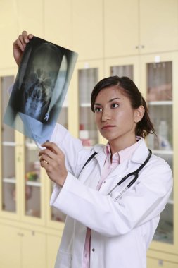 Doktor röntgen görüntüsüne bakıyor.