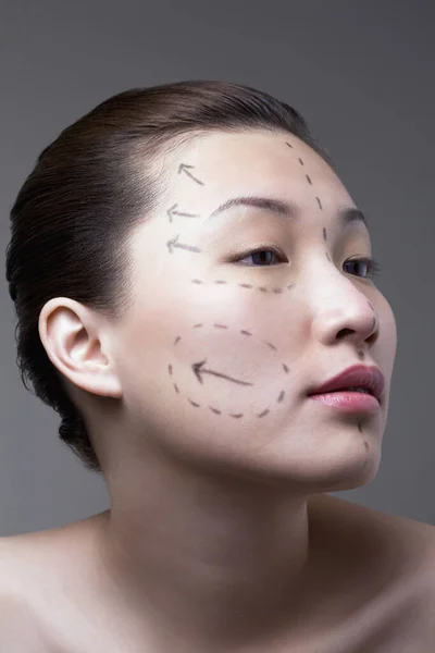 Vrouw Met Cosmetische Chirurgie Markeringen Haar Gezicht — Stockfoto