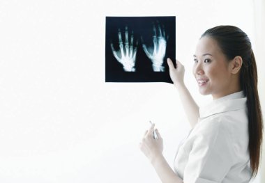 Kadın doktor el röntgenini işaret ediyor.