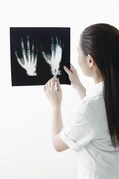 Vrouwelijke Dokter Wijst Naar Hand Ray — Stockfoto