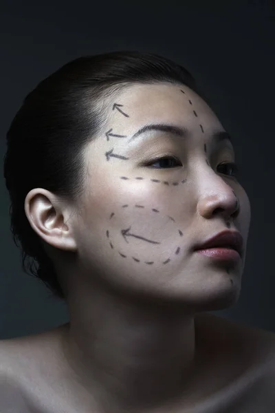 Woman with cosmetic surgery markings on her face