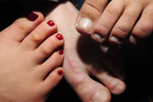 Pie Una Mujer Con Uñas Pintadas Rojo Descalza Verano —  Fotos de Stock