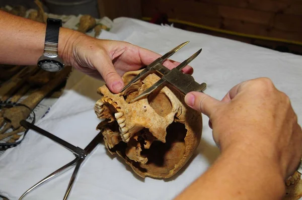 頭蓋骨の鼻を測定し人類学の人間の骨と協力して — ストック写真