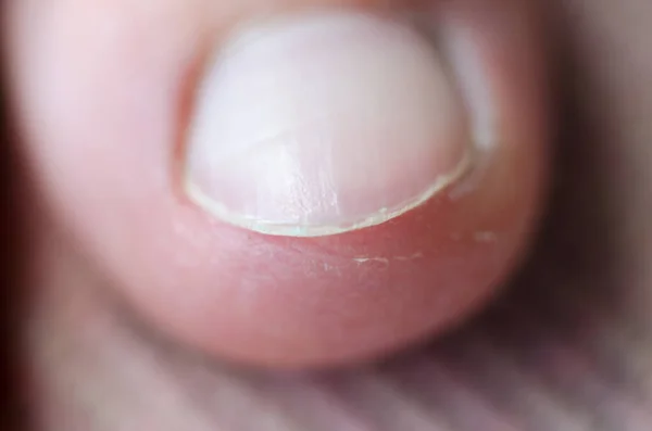 Гвоздь Большой Палец Женской Ноги Красивые Ухоженные Ногти — стоковое фото