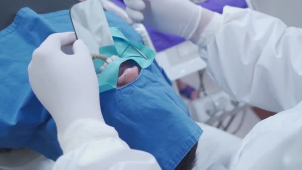 牙科医生为病人进行口腔手术 使用小反射镜在手术室 医生佩戴口罩和手套 医疗外科设备和器械 专业工作等方面进行详细检查 — 图库视频影像