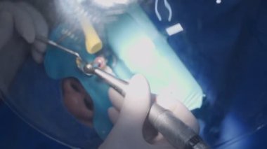 Hastayı ameliyat eden dişçiyi kapatın, beyaz koruyucu eldiven ekipmanları giyin dezenfekte etme, uzman dişçilik matkap aletleri doktor ve asistan, diş aynası, yayılan virüs, su sıçratma  