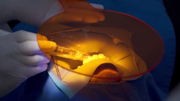 口腔病人的牙科医生 面部盖上口罩 关闭白色防护手套和工作设备工具 Covid Corona病毒保护 牙科护理检查 牙齿美白 — 图库视频影像