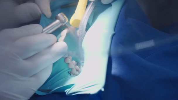 Close Tandarts Opereren Patiënt Dragen Witte Beschermende Handschoenen Apparatuur Gereedschap — Stockvideo