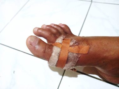 Adamın bacağındaki kanayan yara bandajlarla kaplıydı. Yara bakımı için yama. Güvenlik. Acı.