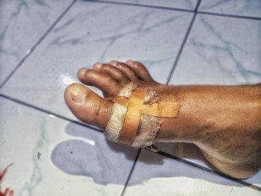 Adamın bacağındaki kanayan yara bandajlarla kaplıydı. Yara bakımı için yama. Güvenlik. Acı.
