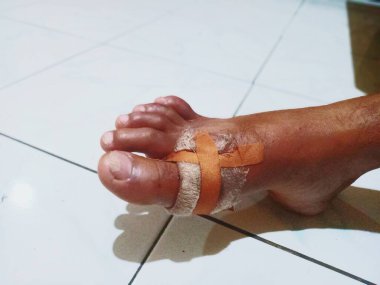 Adamın bacağındaki kanayan yara bandajlarla kaplıydı. Yara bakımı için yama. Güvenlik. Acı.