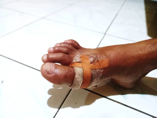 Herida Sangrante Pierna Del Hombre Estaba Cubierta Con Vendajes Parche — Foto de Stock
